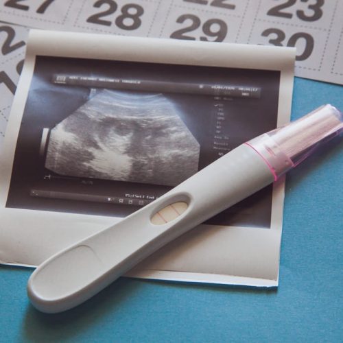 Clomifeno y fertilización in vitro: guía para personas de  Honduras